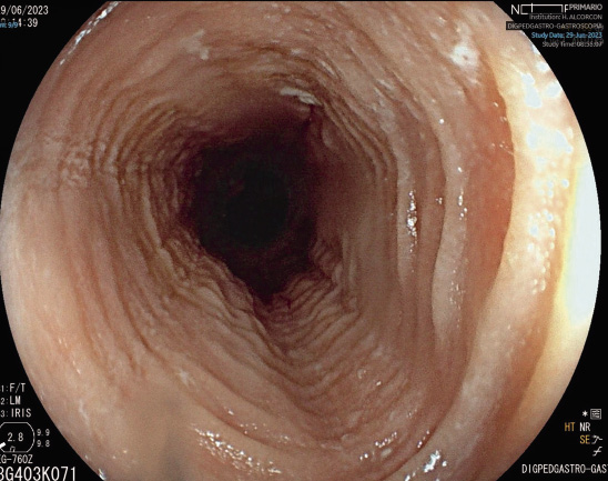 Circle Dilation: Entiende el Concepto y sus Aplicaciones