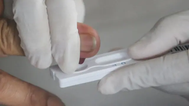 Cómo calcular la sensibilidad del test COVID-19 en un modelo