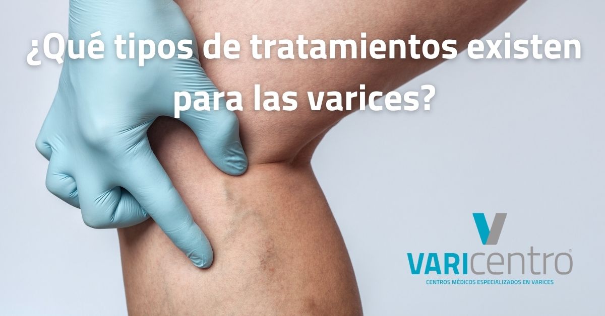 varicentro soluciones efectivas para tus problemas venosos